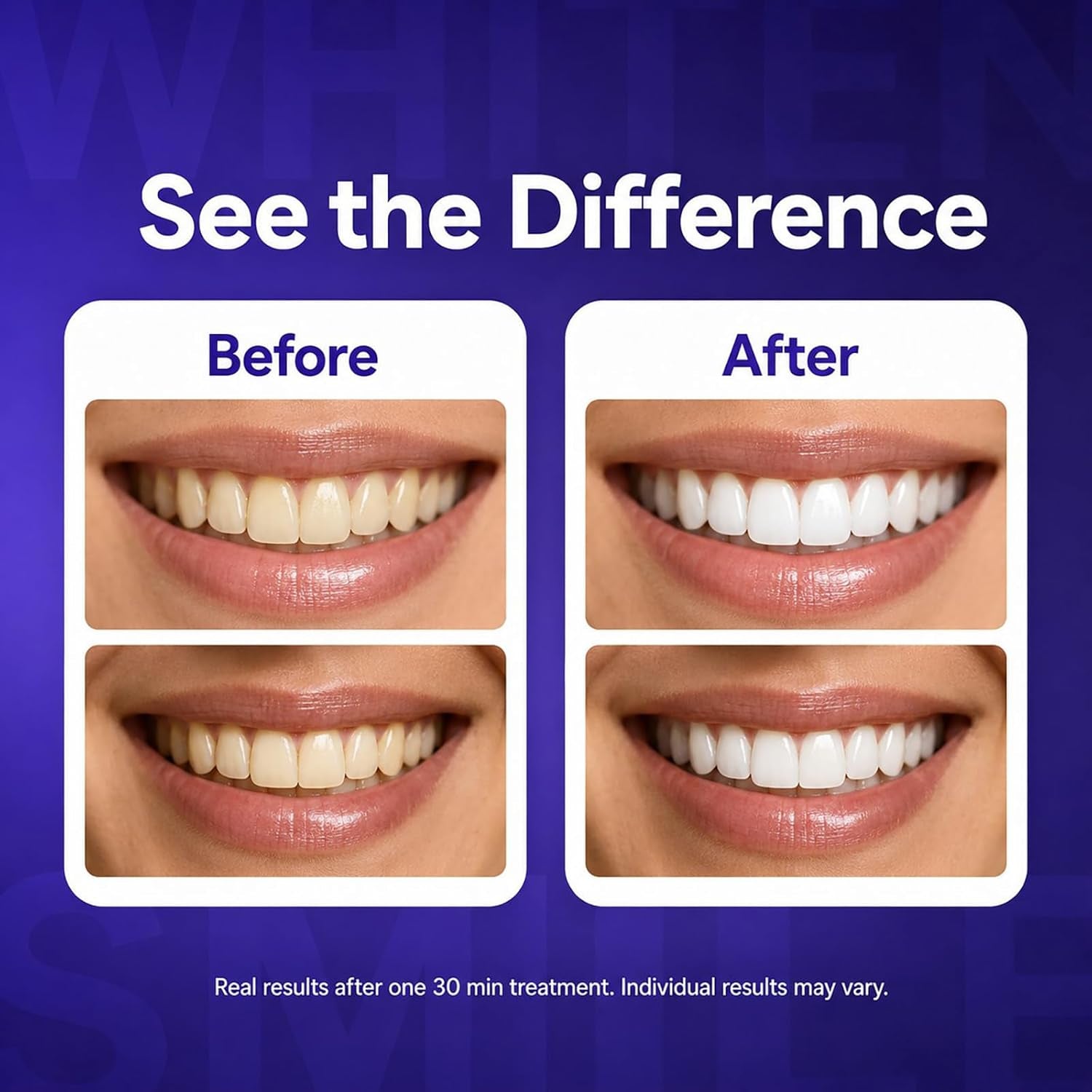 Dent Teeth Whitening Strips, Purple Teeth Whitening Strips for Sensitive Teeth, Purple Whitening Strips for Surface Stains, Enamel Safe, Low Sensitivity, Portable Non-Slip Dry Strips, 14 Count